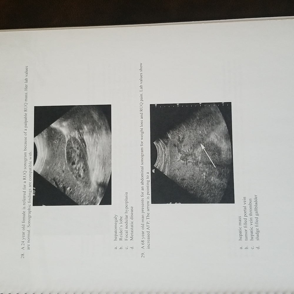 Pegasus Lectures Ultrasound Registry Abdomen Exam Book - Picture 5 of 9